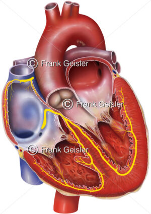 Anatomie Erregungsleitung Herz, Sinusknoten SA-Knoten und Atrioventrikularknoten AV-Knoten - Medical Pictures
