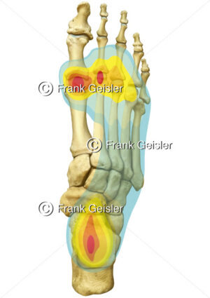 Anatomie Fuß, Knochen Fußskelett mit Belastungszonen von dorsal - Medical Pictures