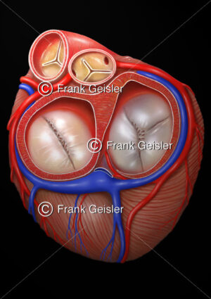 Anatomie Herz, Schnitt entlang der Ventilebene mit Herzklappen (Ventile) - Medical Pictures