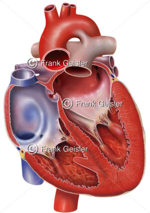Anatomie Herz eines Fetus, eröffnetes Herz mit Vorhöfe (Atrien) und Herzkammern (Ventrikel) - Medical Pictures