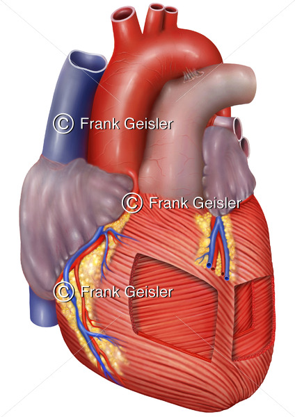 Anatomie Herz mit Herzsmuskulatur, Schichten beim Herzmuskel Myokard - Medical Pictures