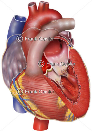 Anatomie Herz mit Mitralklappe Valva mitralis, linke Atrioventrikularklappe, Bikuspidalklappe und Aortenklappe - Medical Pictures
