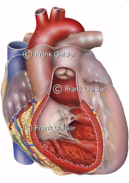 Anatomie Herz mit Pericardium (Herzbeutel), rechte Herzkammer (Ventrikel) eröffnet - Medical Pictures