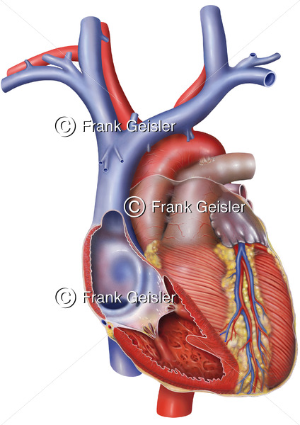 Anatomie Herz, rechter Vorhof (Atrium) und rechte Herzkammer (Ventrikel) eröffnet - Medical Pictures