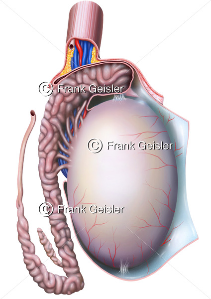 Anatomie Hoden (Testis) und Nebenhoden (Epididymis) - Medical Pictures