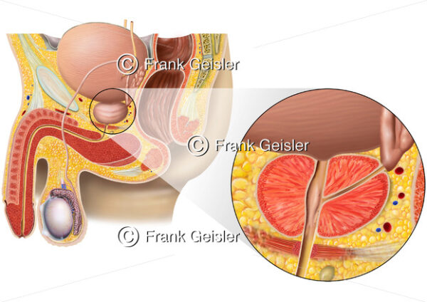 Anatomie Prostata, Becken vom Mann mit Geschlechtsorgane und Vorsteherdrüse - Medical Pictures