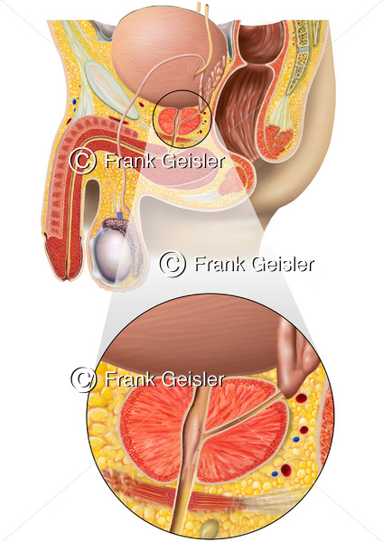 Anatomie Prostata, männliches Becken mit Geschlechtsorgane und Vorsteherdrüse - Medical Pictures