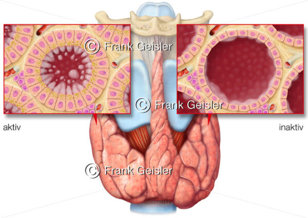 Anatomie Schilddrüse, Glandula thyreoidea mit Follikel (Follikelepithelzellen, Thyreozyten) - Medical Pictures