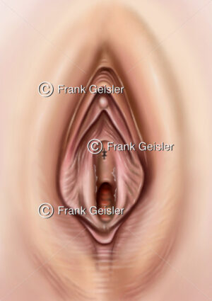 Anatomie Vulva der Frau mit Geschlechtsorgane Schamlippen, Kitzler (Klitoris) und Vagina - Medical Pictures