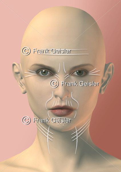 Anti-Aging der Frau, Haut mit Hautfalten und Altersfalten im Gesicht - Medical Pictures