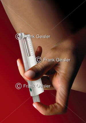Applikation mit Insulin-Pen bei Diabetes mellitus (Zuckerkrankheit) - Medical Pictures