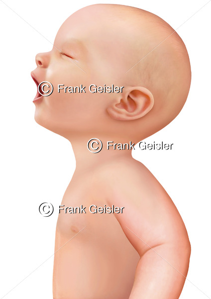 Baby (Säugling) nach der Geburt im ersten Lebensjahr - Medical Pictures