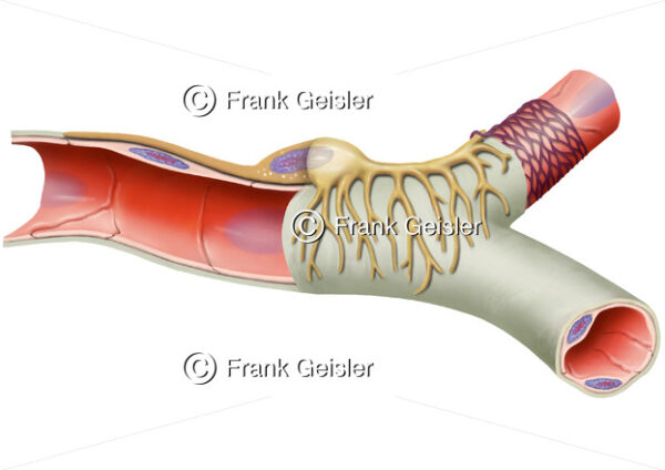 Blutgefäße, Histologie Arteriolen mit Perizyt - Medical Pictures