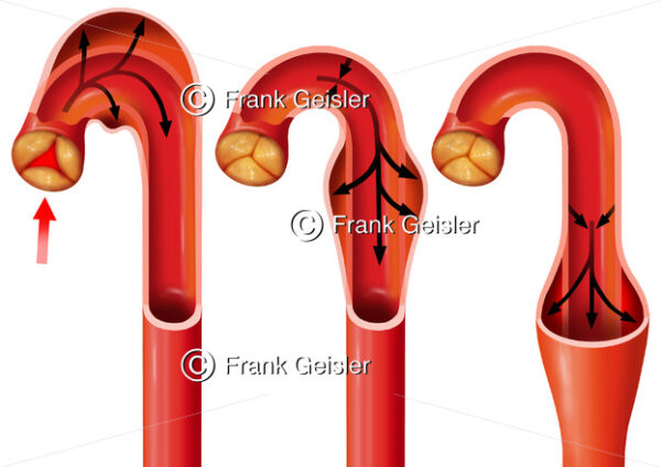 Blutkreislauf, Anatomie Windkessel  der Aorta, Aortenwindkessel - Medical Pictures