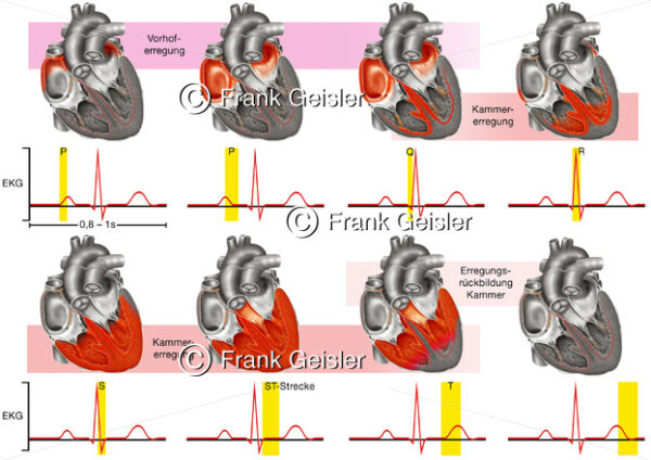 EKG Herz, Herzerregung über Erregungsleitungssystem - Medical Pictures