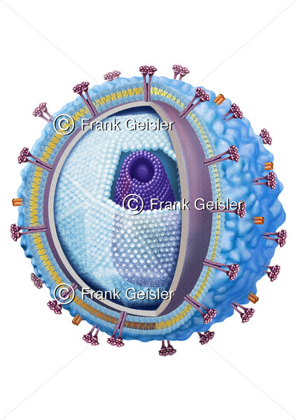 FSME-Virus, Hirnhautentzündung durch Viren, Virusmeningitis - Medical Pictures