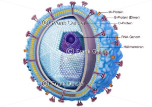 FSME-Virus, Hirnhautentzündung durch Viren, Virusmeningitis - Medical Pictures