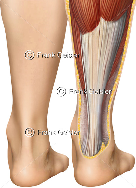 Fuß von hinten mit Achillessehne Tendo calcaneus und Wadenmuskeln - Medical Pictures