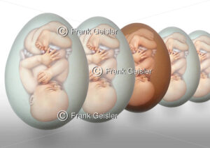 Genetik und Embryologie, Genmanipulation mit Gentechnik - Medical Pictures