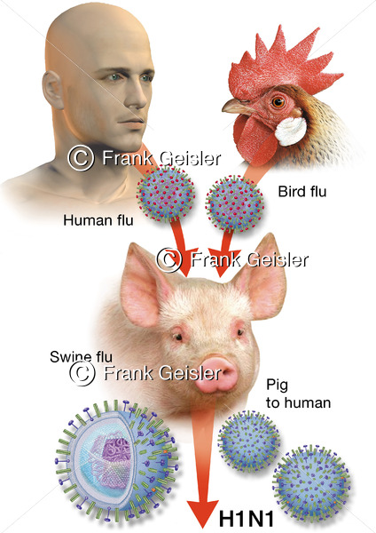 H1N1 Schweinegrippevirus, Virus der Schweineinfluenza - Medical Pictures