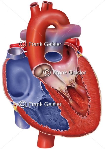 Herz mit Ductus arteriosus (Ductus arteriosus Botalli, Ductus Botalli) - Medical Pictures