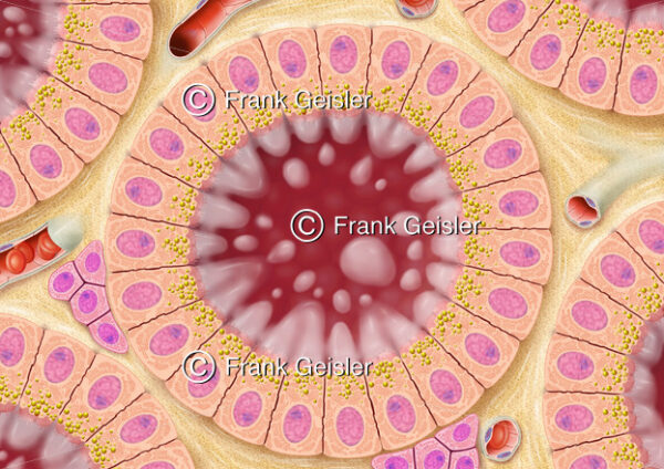 Histologie der Schilddrüse (Glandula thyreoidea), Überfunktion (Hyperthyreose) der Drüse - Medical Pictures