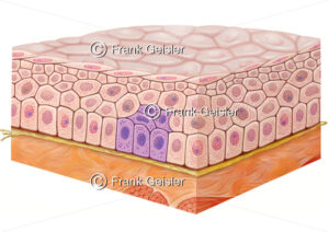 Karzinogenese, Tumorwachstum oder Tumorentwicklung, Schleimhautepithel mit Dysplasie Grad 1 - Medical Pictures