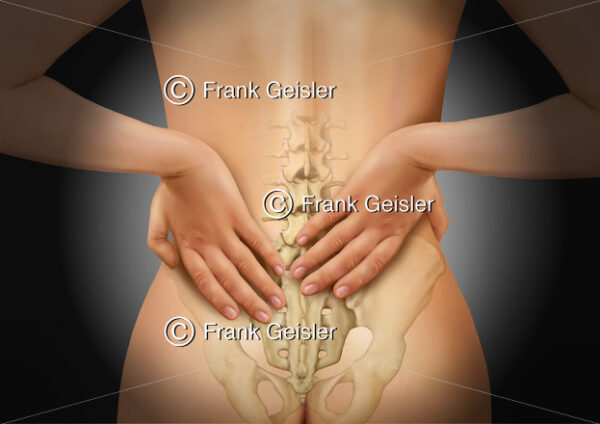 Kreuzschmerz, Rückenschmerzen im Bereich der Lendenwirbelsäule - Medical Pictures