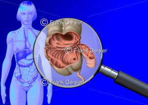 Medical Art Dünndarm, Blinddarm und Dickdarm der Frau, innere Organe im menschlichen Körper - Medical Pictures
