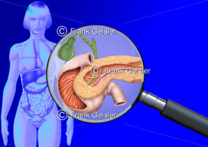 Medical Art Gallenblase, Bauchspeicheldrüse und Zwölffingerdarm der Frau, innere Organe im menschlichen Körper - Medical Pictures