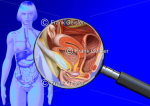 Medical Art Geschlechtsorgane der Frau, Vulva, Scheide Vagina, Gebärmutter Uterus und Eierstock Ovar - Medical Pictures