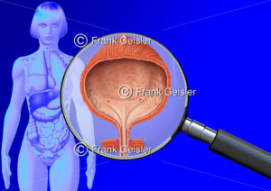 Medical Art Harnblase Vesica urinaria der Frau, innere Organe im menschlichen Körper - Medical Pictures