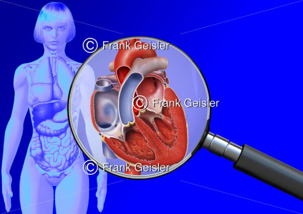 Medical Art Herz der Frau, innere Organe im menschlichen Körper - Medical Pictures
