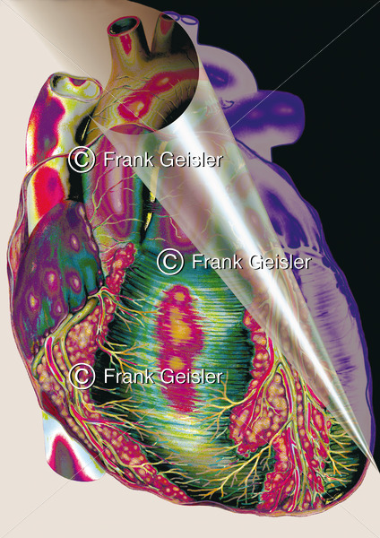 Medical Art Herz mit Koronargefäße - Medical Pictures