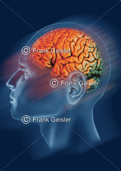 Medical Art Kopf mit Gehirn, Lateralansicht der Hemisphäre - Medical Pictures
