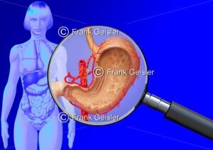 Medical Art Magen der Frau, innere Organe im menschlichen Körper - Medical Pictures