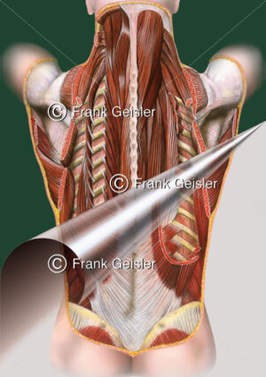 Medical Art Muskulatur, autochthone Rückenmuskulatur - Medical Pictures