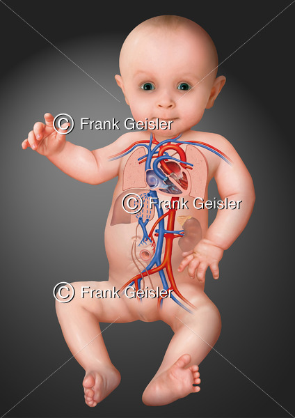 Neugeborenes Baby mit postnatalen (nachgeburtlichen) Blutkreislauf - Medical Pictures