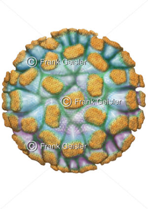 Norwalk-Like-Virus NLV, Infektion durch Norovirus im Magen-Darm-Trakt - Medical Pictures