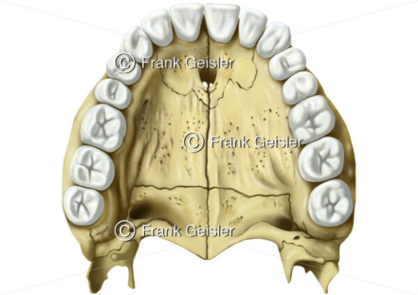 Oberkiefer mit Knochenplatten im Gaumen und obere Zahnreihe - Medical Pictures