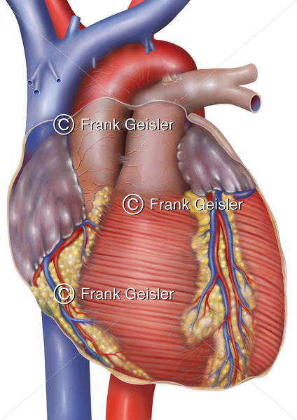 Organspende, Herz vor Herztransplantation in der Transplantationsmedizin - Medical Pictures