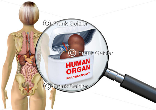 Organtransplantation Niere der Frau, innere Organe im menschlichen Körper - Medical Pictures