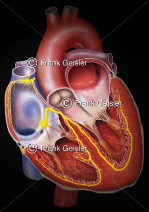 Physiologie Herz, Erregungsleitungssystem mit Sinusknoten und AV-Knoten - Medical Pictures