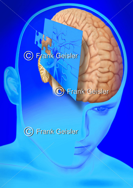 Puzzle mit Nervenzelle (Neuron) und Gehirn, Medical Art Diagnostik in der Neurologie - Medical Pictures