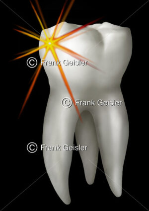 Zahn (Dens) mit Zahnkrone (Corona) und Zahnwurzel (Radix) - Medical Pictures