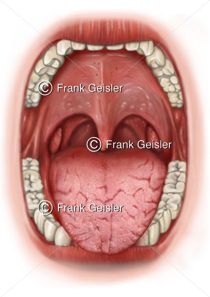 Zungendiagnostik, Zungendiagnose Zungenfalten der Zunge, Faltenzunge